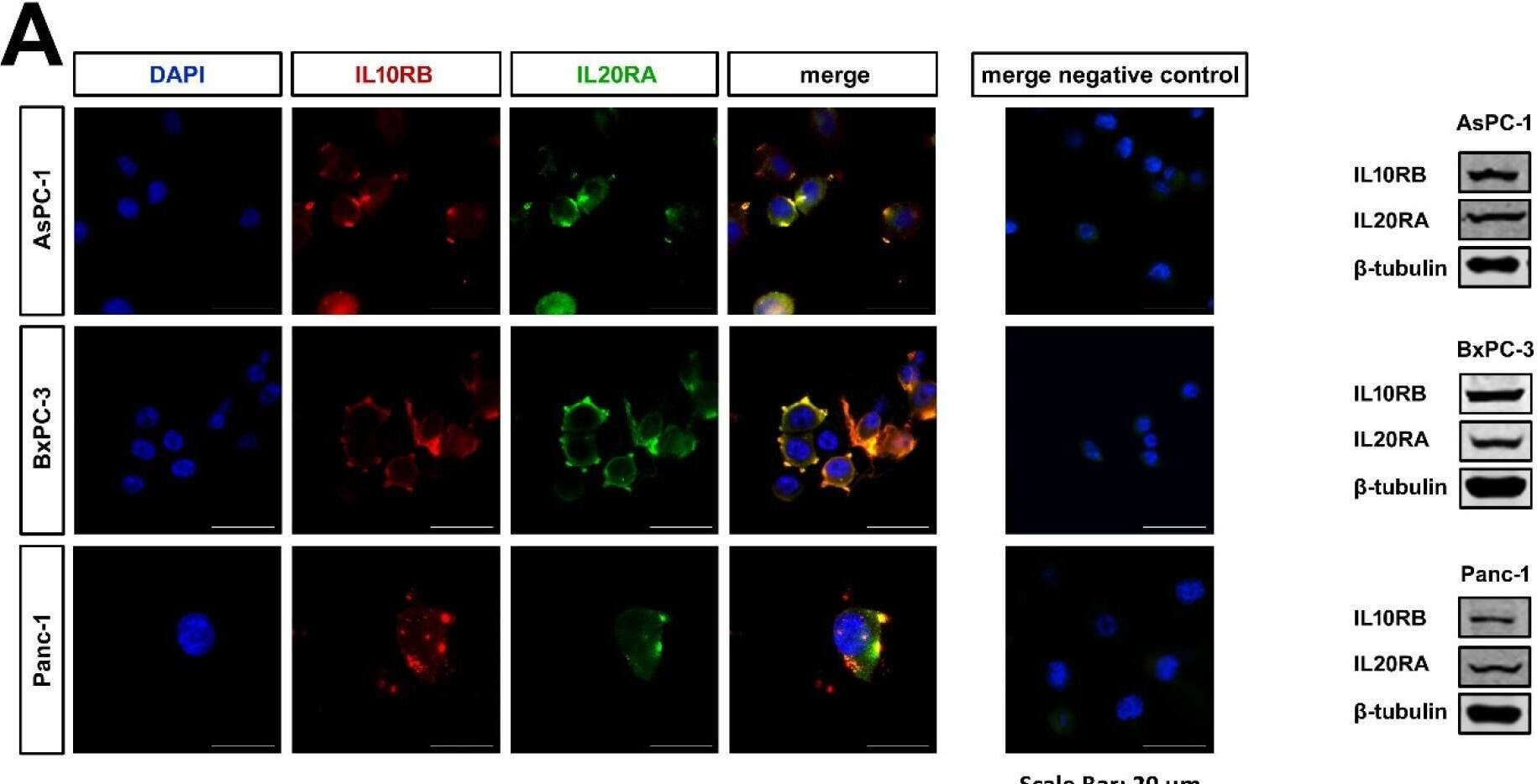 IL-20R alpha Antibody (MM0394-9F40) - Azide and BSA Free