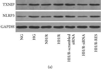 NLRP3/NALP3 Antibody - BSA Free