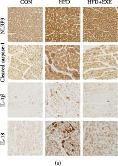 NLRP3/NALP3 Antibody - BSA Free