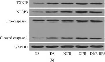 NLRP3/NALP3 Antibody - BSA Free
