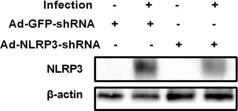 NLRP3/NALP3 Antibody - BSA Free