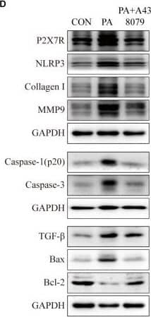 NLRP3/NALP3 Antibody - BSA Free