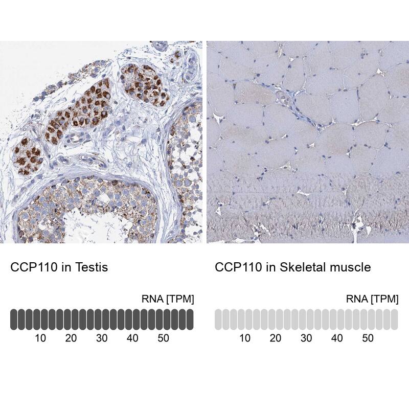 CCP110 Antibody - BSA Free Immunohistochemistry: CCP110 Antibody - BSA Free [NBP2-13073]