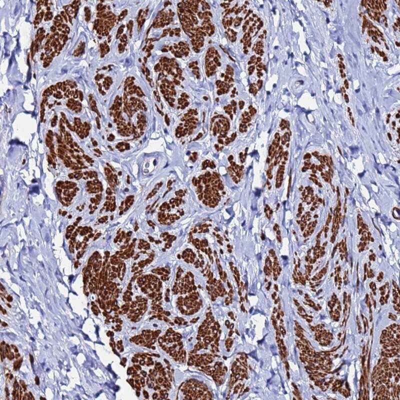 RAB39 Antibody - BSA Free Immunohistochemistry: RAB39 Antibody - BSA Free [NBP2-13193]