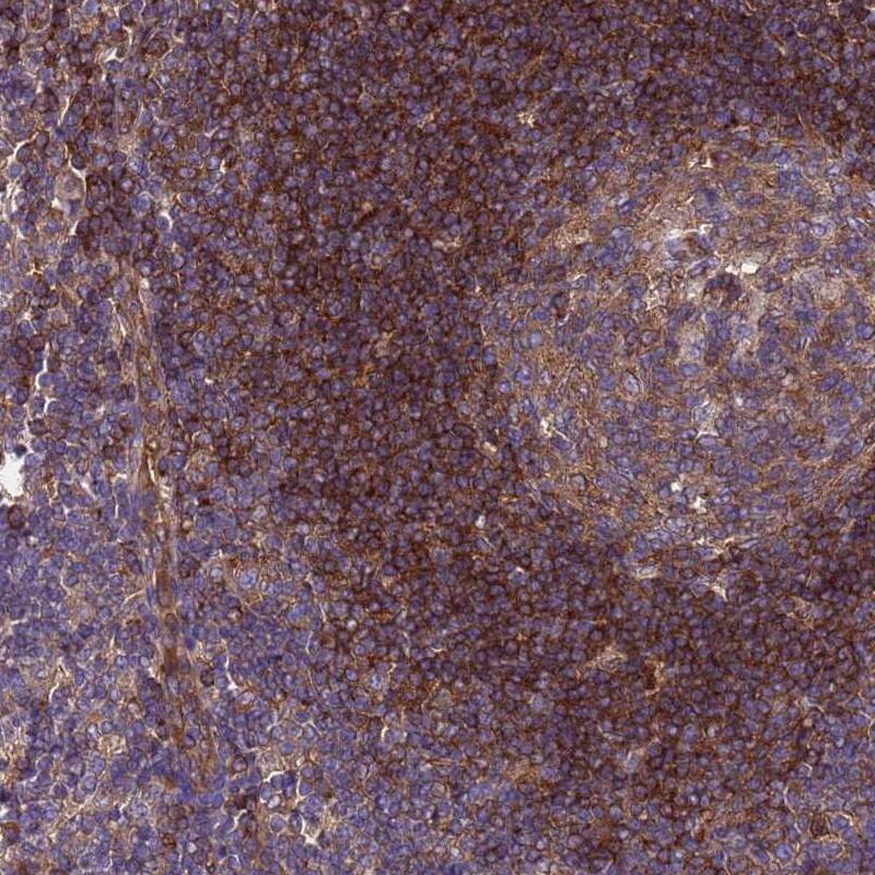RABEP2 Antibody - BSA Free Immunohistochemistry: RABEP2 Antibody - BSA Free [NBP2-13195]