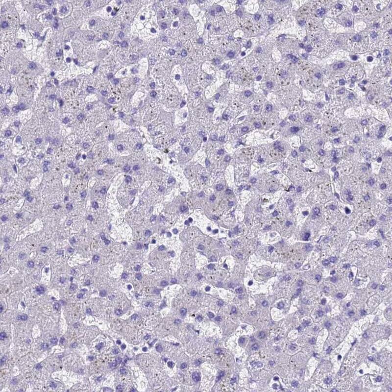 RABEP2 Antibody - BSA Free Immunohistochemistry: RABEP2 Antibody - BSA Free [NBP2-13195]