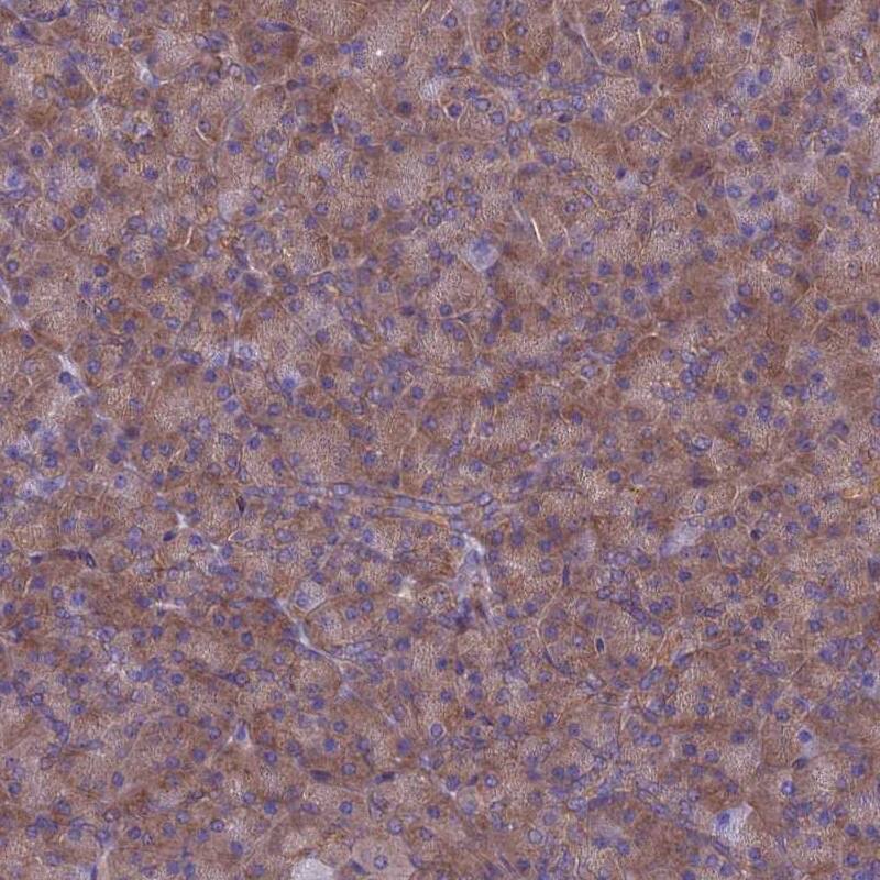RABEP2 Antibody - BSA Free Immunohistochemistry: RABEP2 Antibody - BSA Free [NBP2-13195]