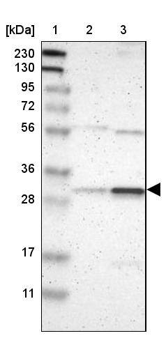 Rad1 Antibody - BSA Free Western Blot: Rad1 Antibody - BSA Free [NBP2-13196]