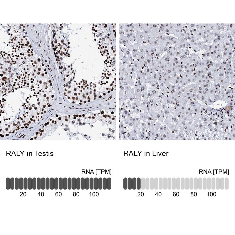 RALY Antibody - BSA Free Immunohistochemistry: RALY Antibody - BSA Free [NBP2-13200]