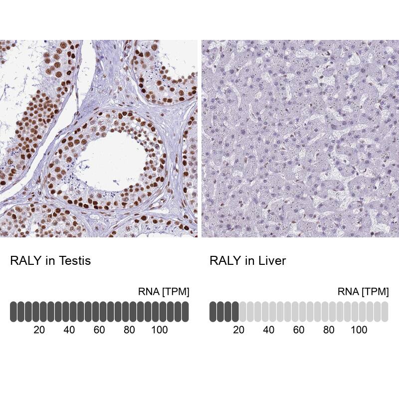 RALY Antibody - BSA Free Immunohistochemistry: RALY Antibody - BSA Free [NBP2-13201]