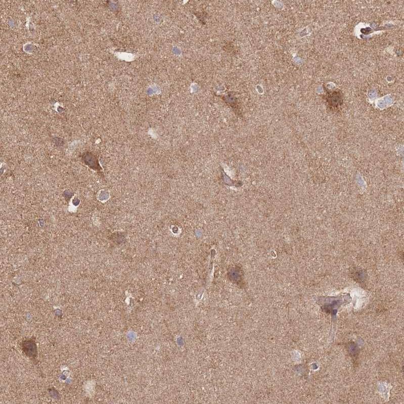 RASSF2 Antibody - BSA Free Immunohistochemistry: RASSF2 Antibody - BSA Free [NBP2-13206]
