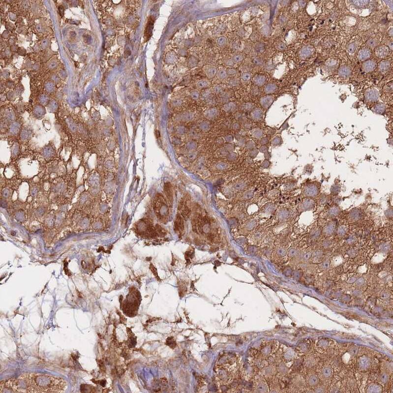 RASSF2 Antibody - BSA Free Immunohistochemistry: RASSF2 Antibody - BSA Free [NBP2-13206]