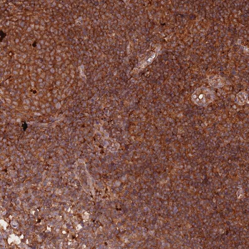RASSF2 Antibody - BSA Free Immunohistochemistry: RASSF2 Antibody - BSA Free [NBP2-13206]