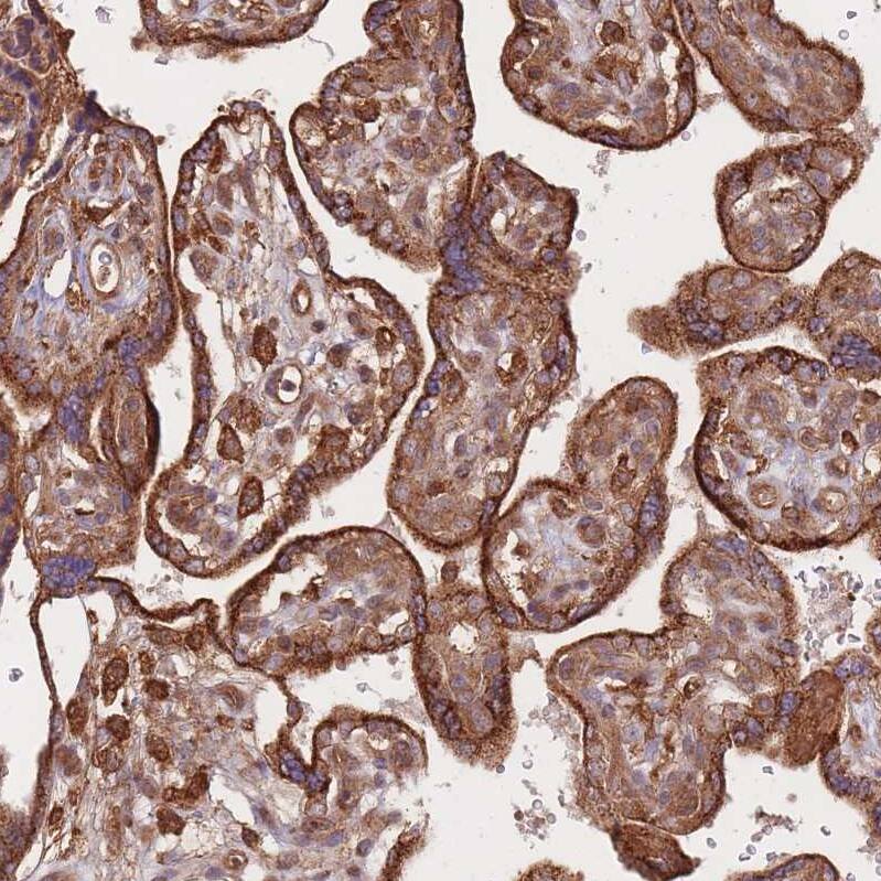 RASSF2 Antibody - BSA Free Immunohistochemistry: RASSF2 Antibody - BSA Free [NBP2-13206]