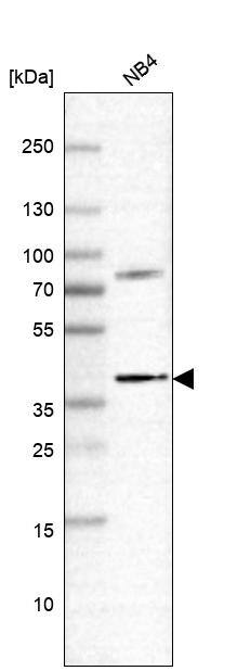 RASSF2 Antibody - BSA Free Western Blot: RASSF2 Antibody - BSA Free [NBP2-13206]