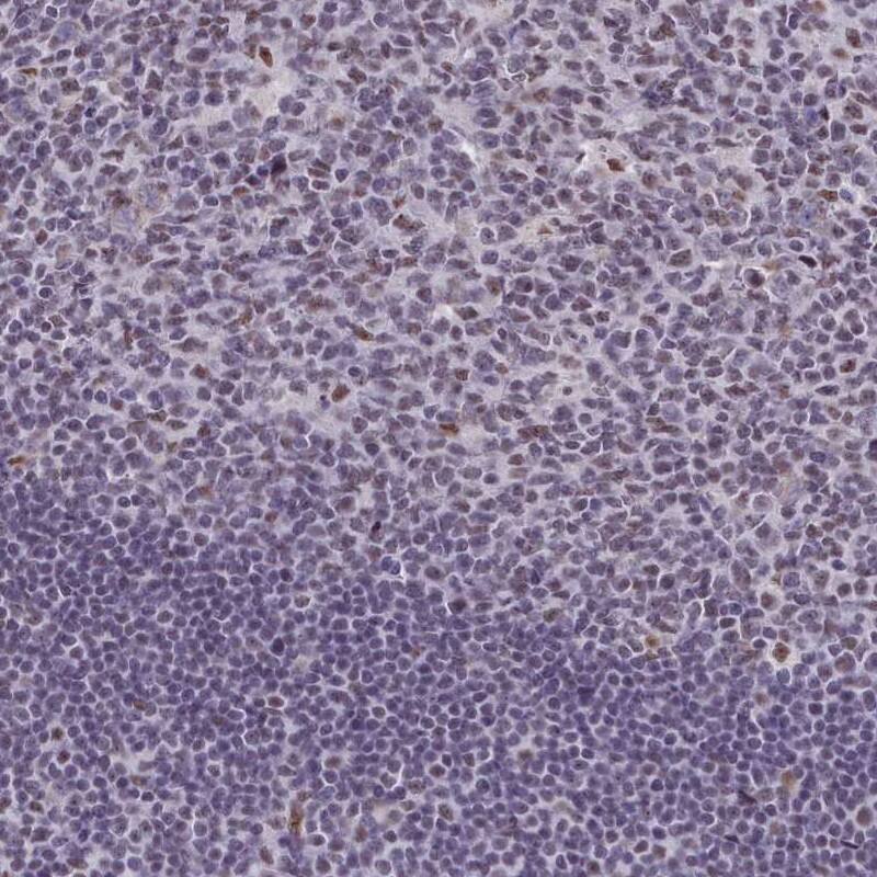 RBM12 Antibody - BSA Free Immunohistochemistry: RBM12 Antibody - BSA Free [NBP2-13207]