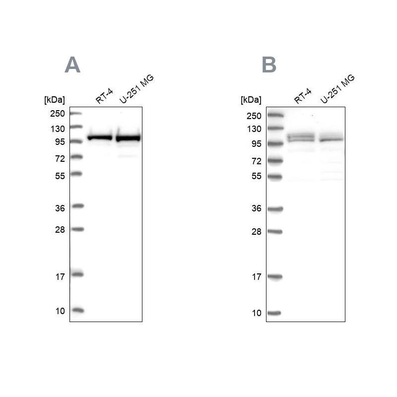 RBM12 Antibody - BSA Free Western Blot: RBM12 Antibody - BSA Free [NBP2-13208]