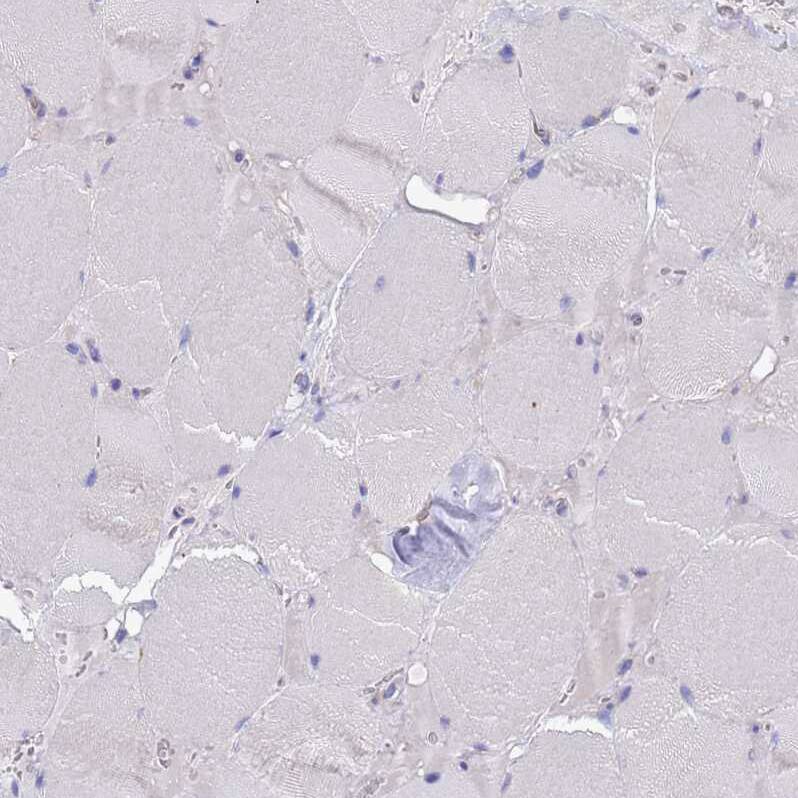 MNAB Antibody - BSA Free Immunohistochemistry: MNAB Antibody - BSA Free [NBP2-13212]