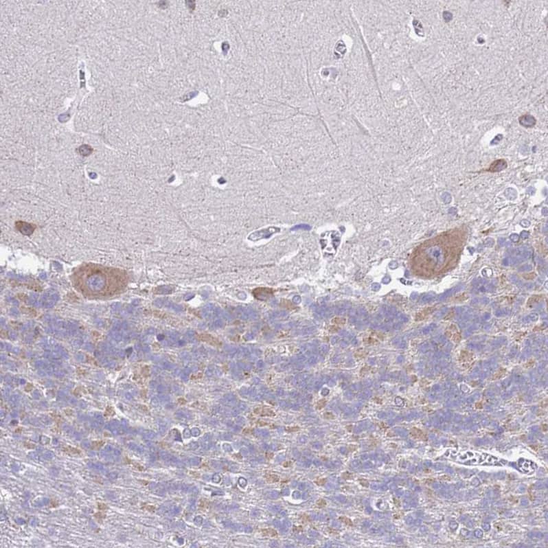 MNAB Antibody - BSA Free Immunohistochemistry: MNAB Antibody - BSA Free [NBP2-13212]