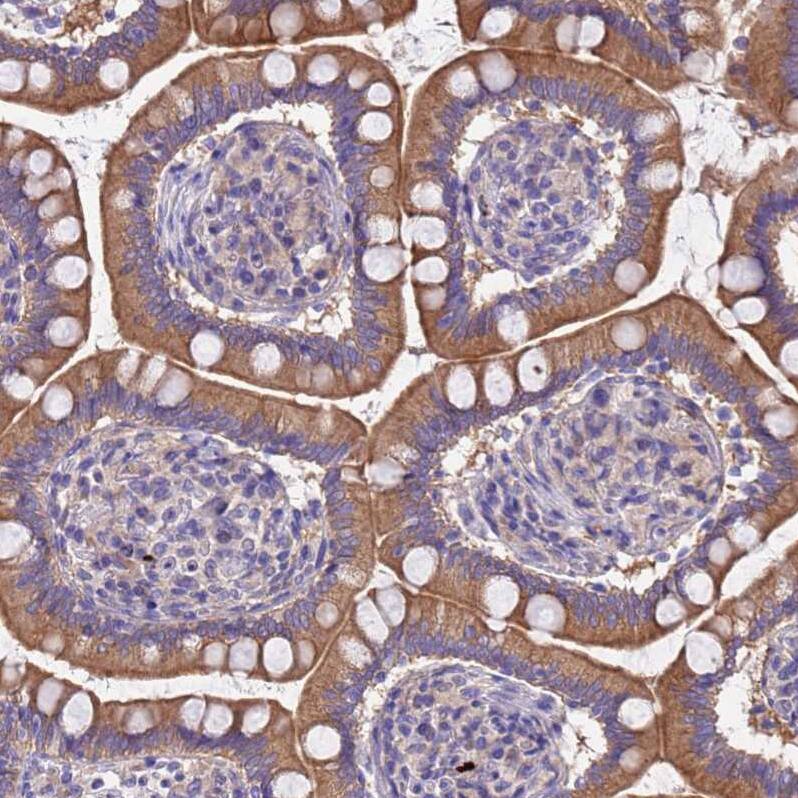 MNAB Antibody - BSA Free Immunohistochemistry: MNAB Antibody - BSA Free [NBP2-13212]