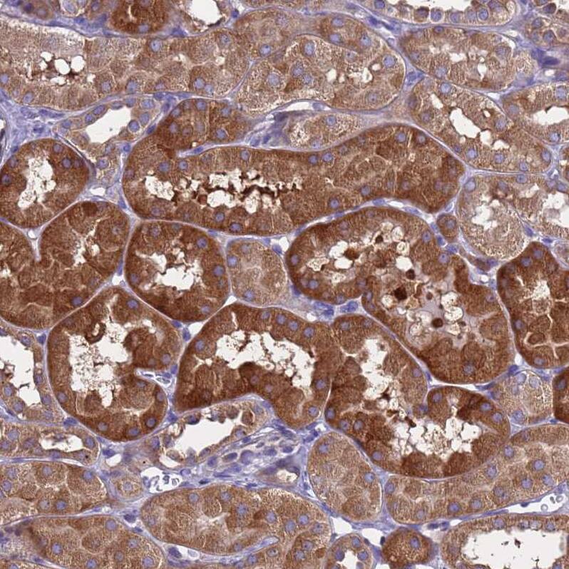 MNAB Antibody - BSA Free Immunohistochemistry: MNAB Antibody - BSA Free [NBP2-13212]