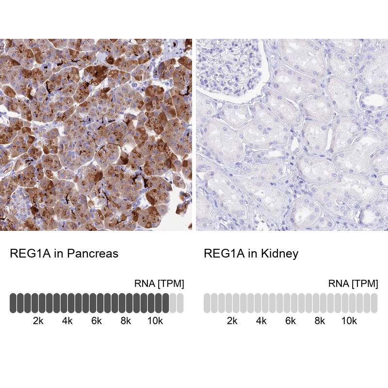 Reg1A Antibody - BSA Free Immunohistochemistry: Reg1A Antibody - BSA Free [NBP2-13215]