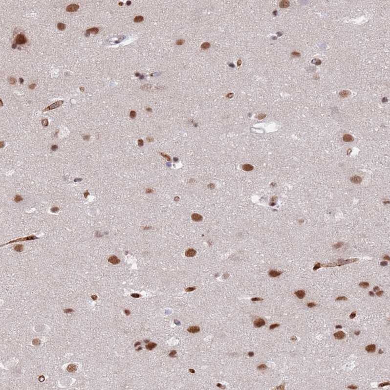 RFX1 Antibody - BSA Free Immunohistochemistry: RFX1 Antibody - BSA Free [NBP2-13223]