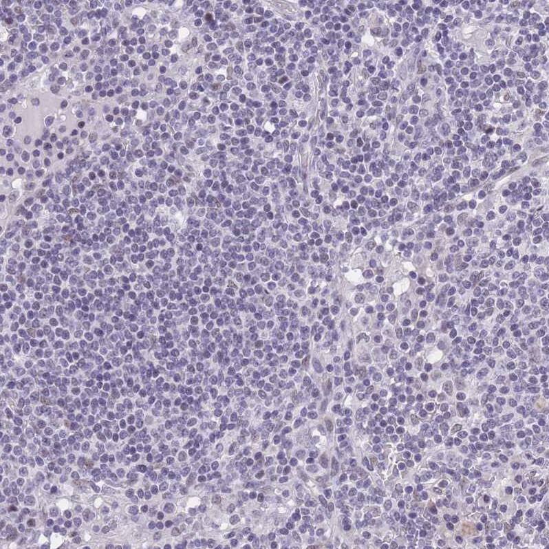 RFX1 Antibody - BSA Free Immunohistochemistry: RFX1 Antibody - BSA Free [NBP2-13223]