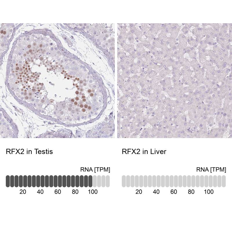 RFX2 Antibody - BSA Free Immunohistochemistry: RFX2 Antibody - BSA Free [NBP2-13224]