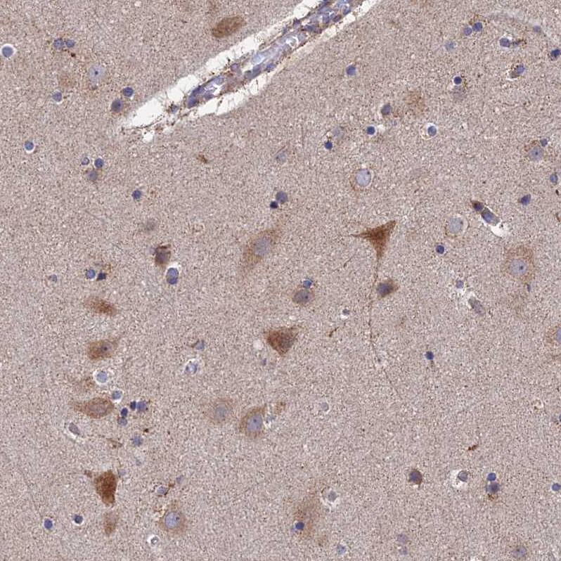 RIC8B Antibody - BSA Free Immunohistochemistry: RIC8B Antibody - BSA Free [NBP2-13232]