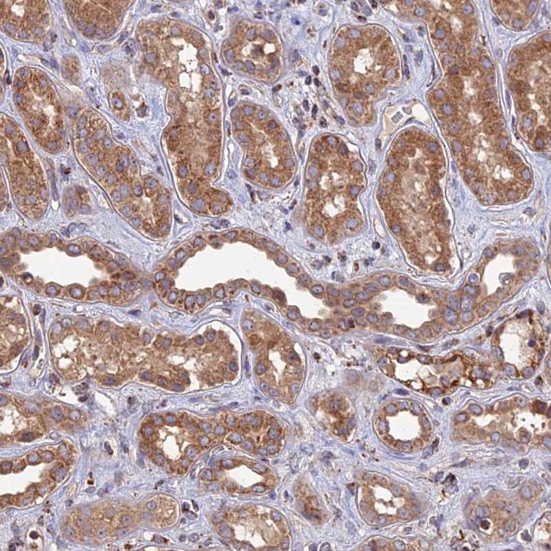 RIC8B Antibody - BSA Free Immunohistochemistry: RIC8B Antibody - BSA Free [NBP2-13232]