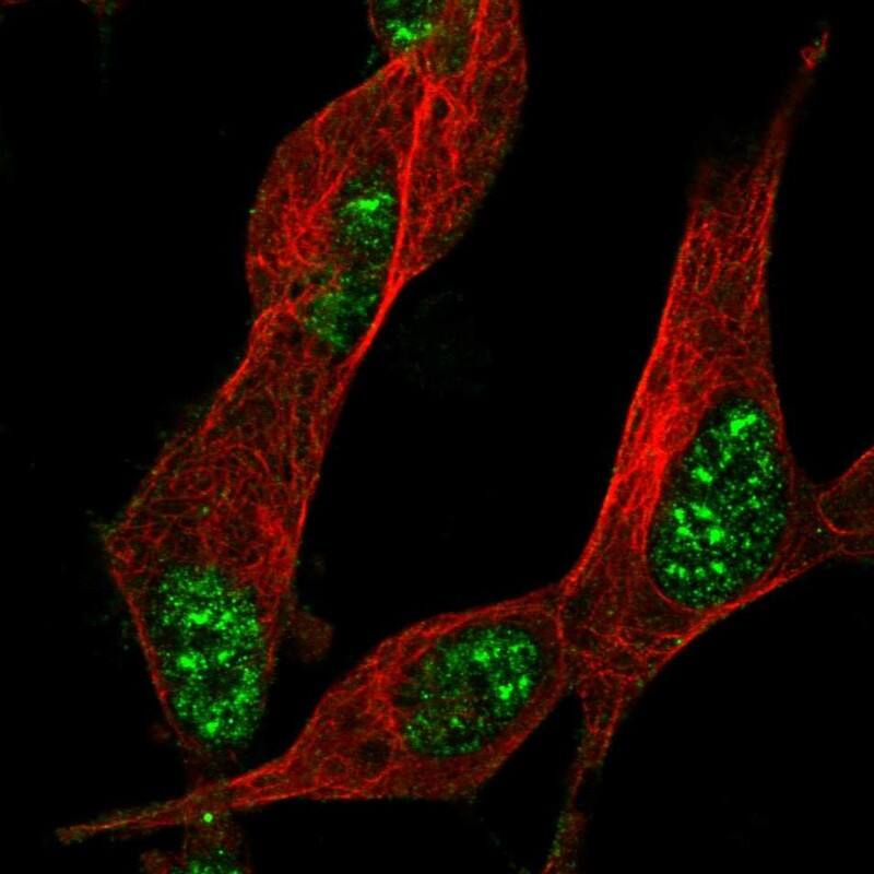 ZNF179 Antibody - BSA Free Immunocytochemistry/ Immunofluorescence: ZNF179 Antibody [NBP2-13236]