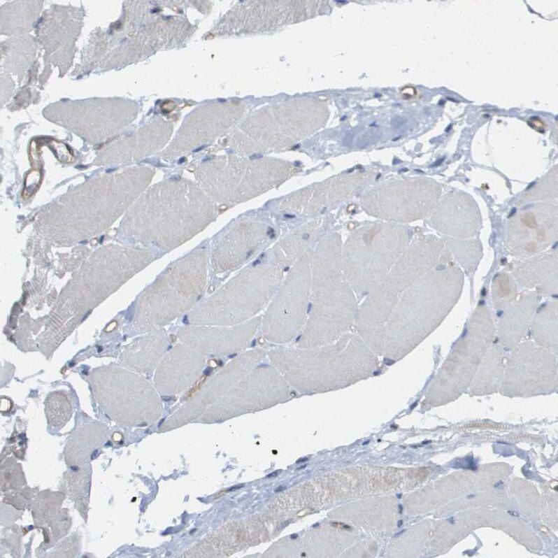 ZNF179 Antibody - BSA Free Immunohistochemistry: ZNF179 Antibody - BSA Free [NBP2-13236]