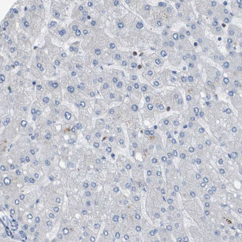 ZNF179 Antibody - BSA Free Immunohistochemistry: ZNF179 Antibody - BSA Free [NBP2-13236]