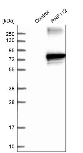 ZNF179 Antibody - BSA Free Western Blot: ZNF179 Antibody - BSA Free [NBP2-13236]
