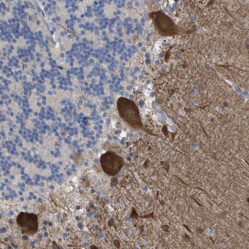 ZNF179 Antibody - BSA Free Immunohistochemistry: ZNF179 Antibody - BSA Free [NBP2-13236]