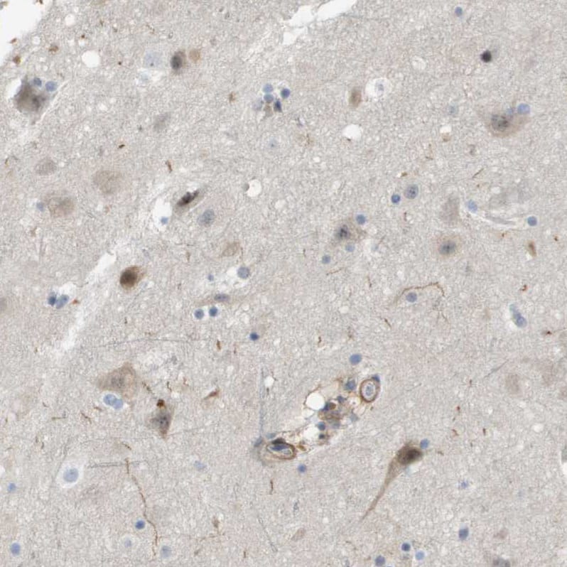 ZNF179 Antibody - BSA Free Immunohistochemistry: ZNF179 Antibody - BSA Free [NBP2-13236]