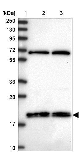 RNF181 Antibody - BSA Free Western Blot: RNF181 Antibody - BSA Free [NBP2-13240]