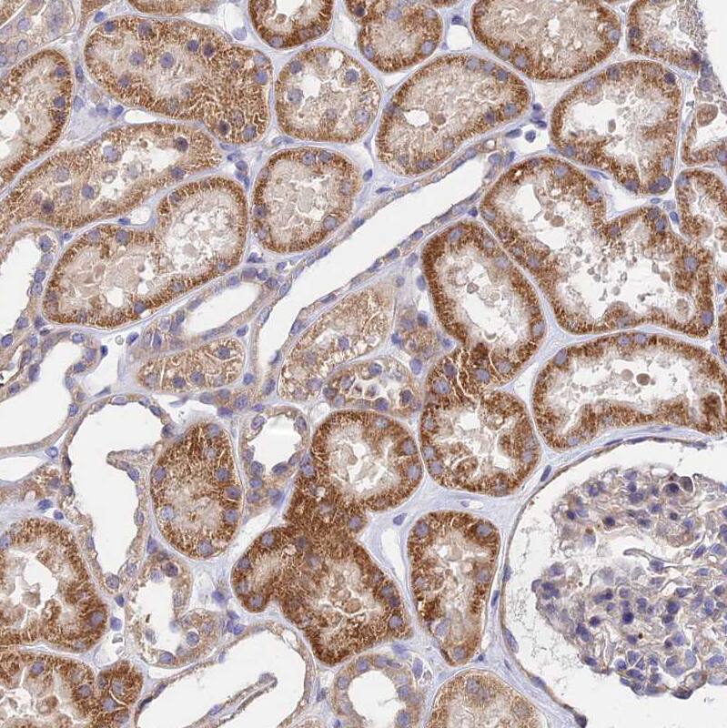 RPAP2 Antibody - BSA Free Immunohistochemistry: RPAP2 Antibody - BSA Free [NBP2-13248]