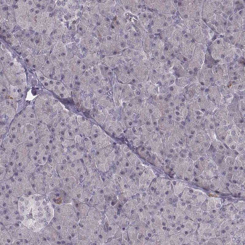 RPGRIP1 Antibody - BSA Free Immunohistochemistry: RPGRIP1 Antibody - BSA Free [NBP2-13249]