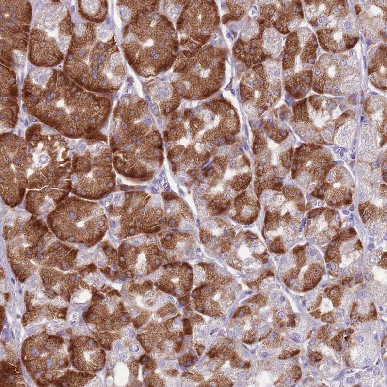 RPL18 Antibody - BSA Free Immunohistochemistry: RPL18 Antibody - BSA Free [NBP2-13251]