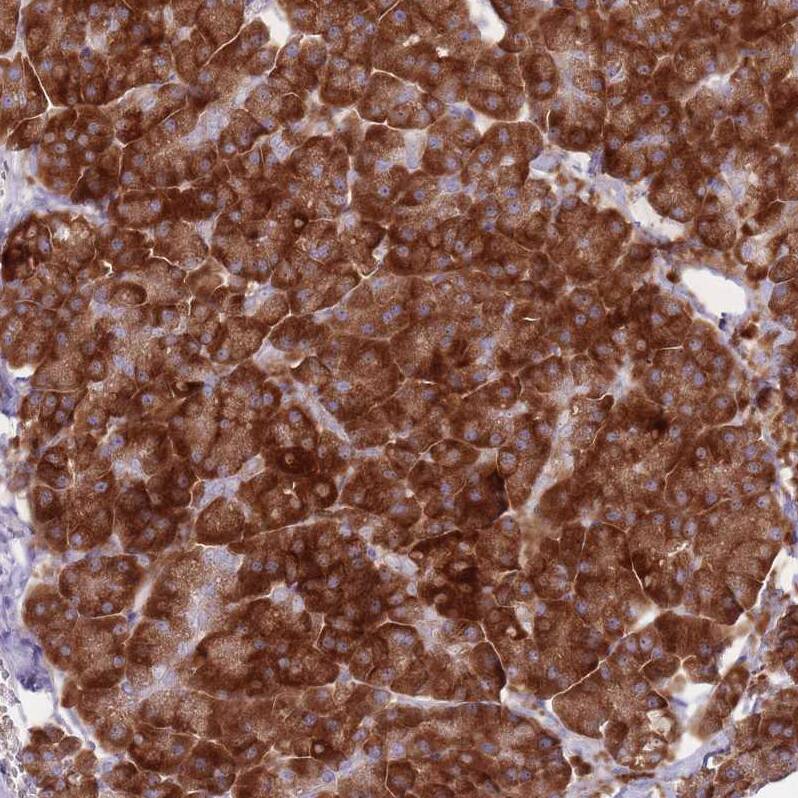 RPL18 Antibody - BSA Free Immunohistochemistry: RPL18 Antibody - BSA Free [NBP2-13251]