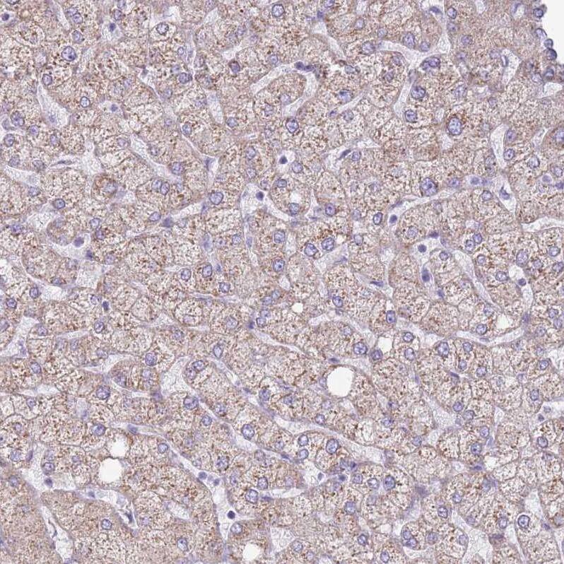 RPL18 Antibody - BSA Free Immunohistochemistry: RPL18 Antibody - BSA Free [NBP2-13251]