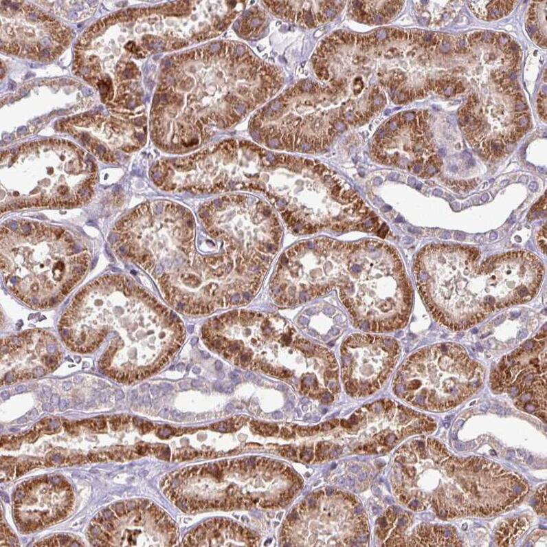 RPL23A Antibody - BSA Free Immunohistochemistry: RPL23A Antibody - BSA Free [NBP2-13253]
