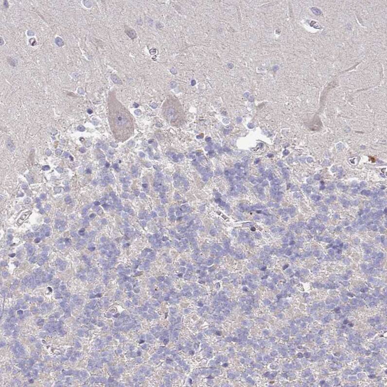 RPL23A Antibody - BSA Free Immunohistochemistry: RPL23A Antibody - BSA Free [NBP2-13253]
