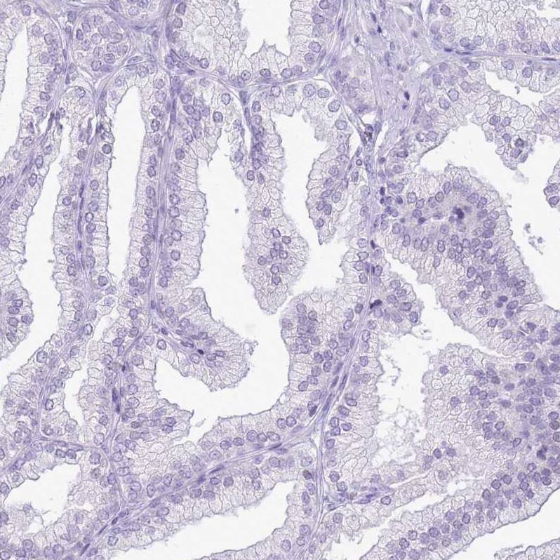 RPL3L Antibody - BSA Free Immunohistochemistry: RPL3L Antibody - BSA Free [NBP2-13257]