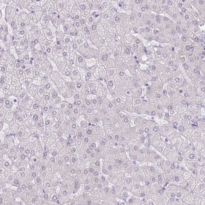 RPL3L Antibody - BSA Free Immunohistochemistry: RPL3L Antibody - BSA Free [NBP2-13257]