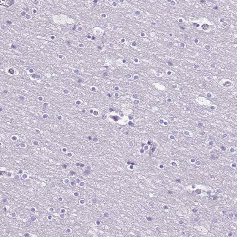RPL3L Antibody - BSA Free Immunohistochemistry: RPL3L Antibody - BSA Free [NBP2-13257]