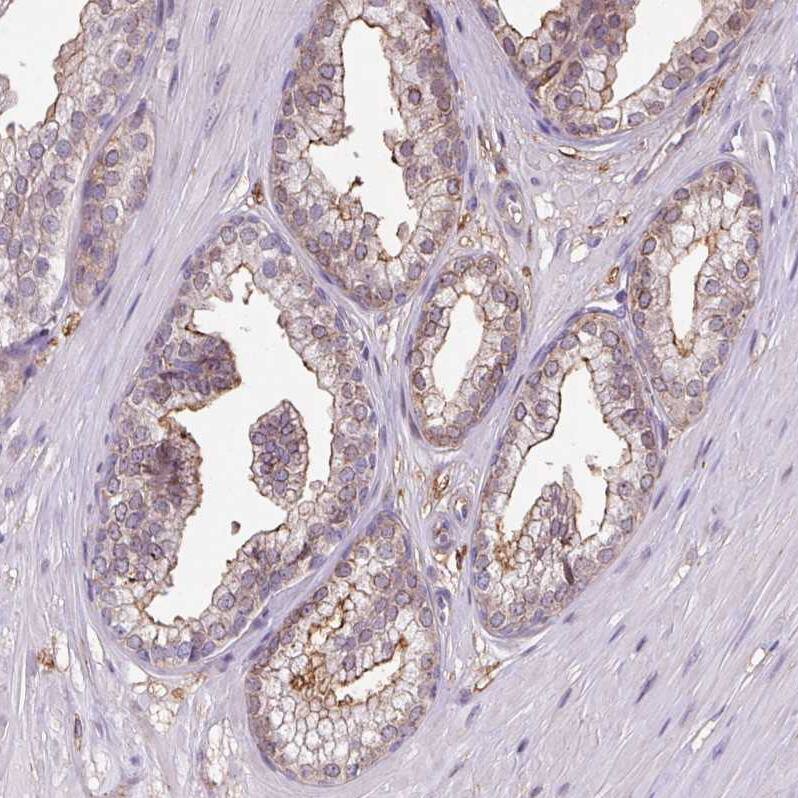 RPP25L Antibody - BSA Free Immunohistochemistry: RPP25L Antibody - BSA Free [NBP2-13259]