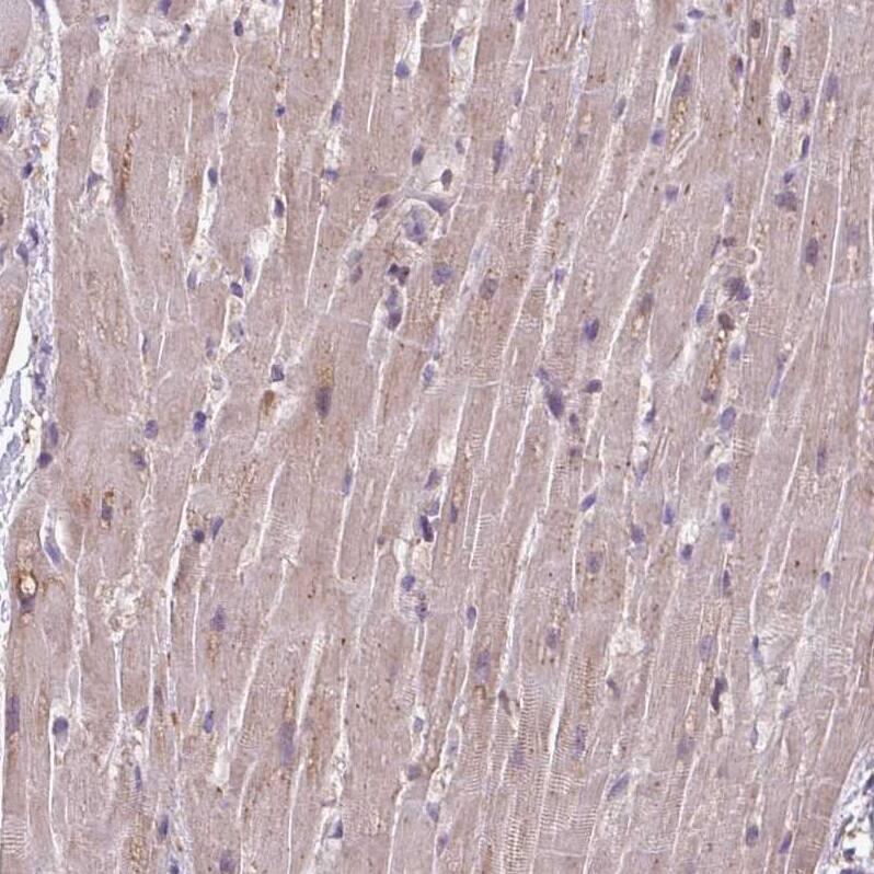 RPP25L Antibody - BSA Free Immunohistochemistry: RPP25L Antibody - BSA Free [NBP2-13259]
